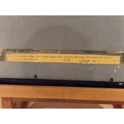 Planche Médicinale - Gravure sur bois